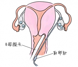 正在备孕能吃六味地黄丸吗